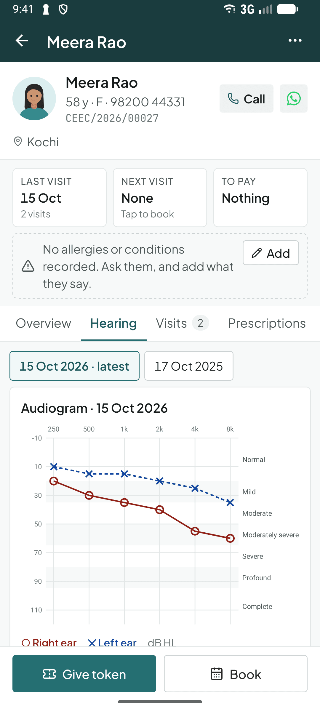 The Hearing tab in the Curogrid ENT phone app: the audiogram with the right ear in red circles and the left in blue crosses, over the WHO grade bands, and the last two tests to switch between