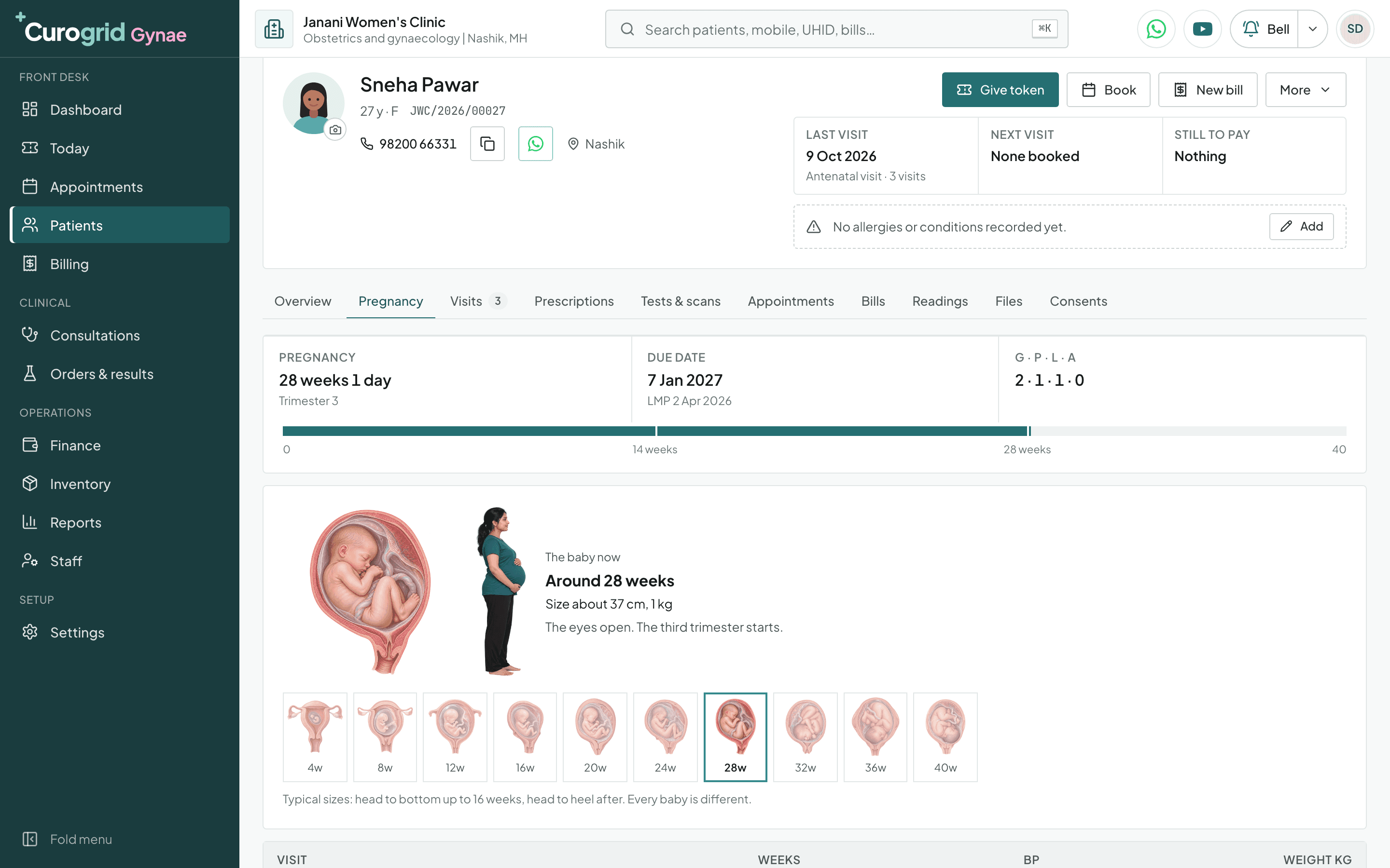 A pregnant patient's Pregnancy tab in Curogrid Gynae: 28 weeks 1 day, trimester 3, due 7 Jan 2027 from an LMP of 2 Apr 2026, G P L A 2 1 1 0 on a 40 week bar, and the baby's stage at 28 weeks, about 37 cm and 1 kg, with a row of stages from 4 to 40 weeks